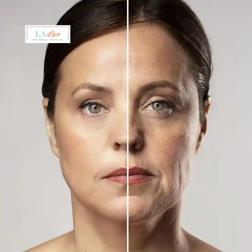 How Can You Tell If Non-Surgical Skin Tightening Is Right for You Mill Hill?