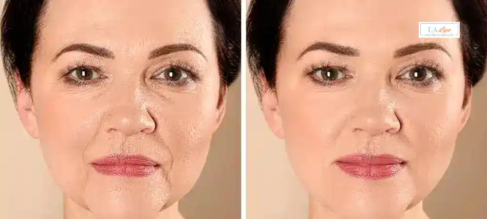 Why Aren’t My Skincare Products Making My Sagging Skin Look Firmer Mill Hill?