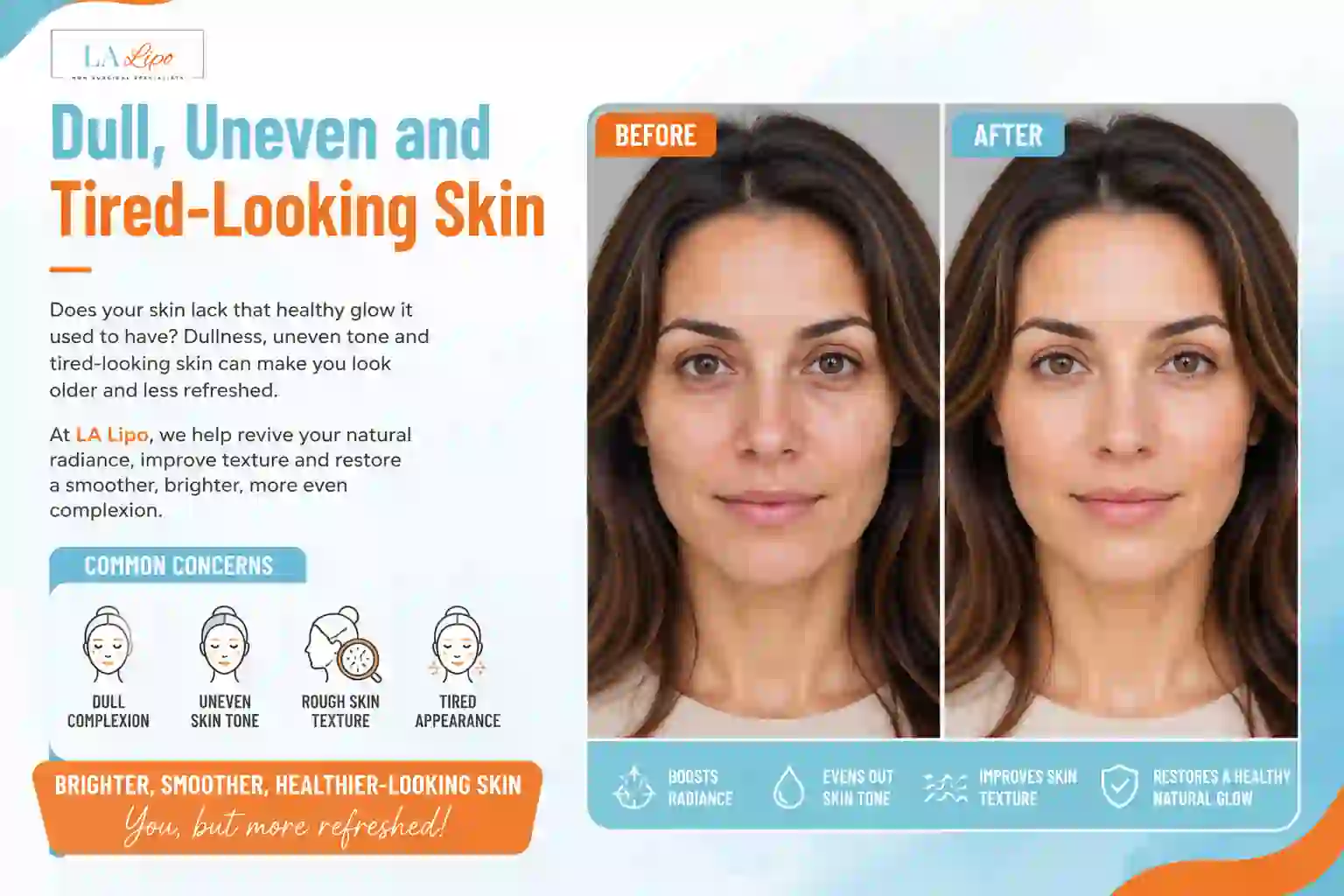 Sign #5: Dull, Uneven and Tired-Looking Skin Mill Hill