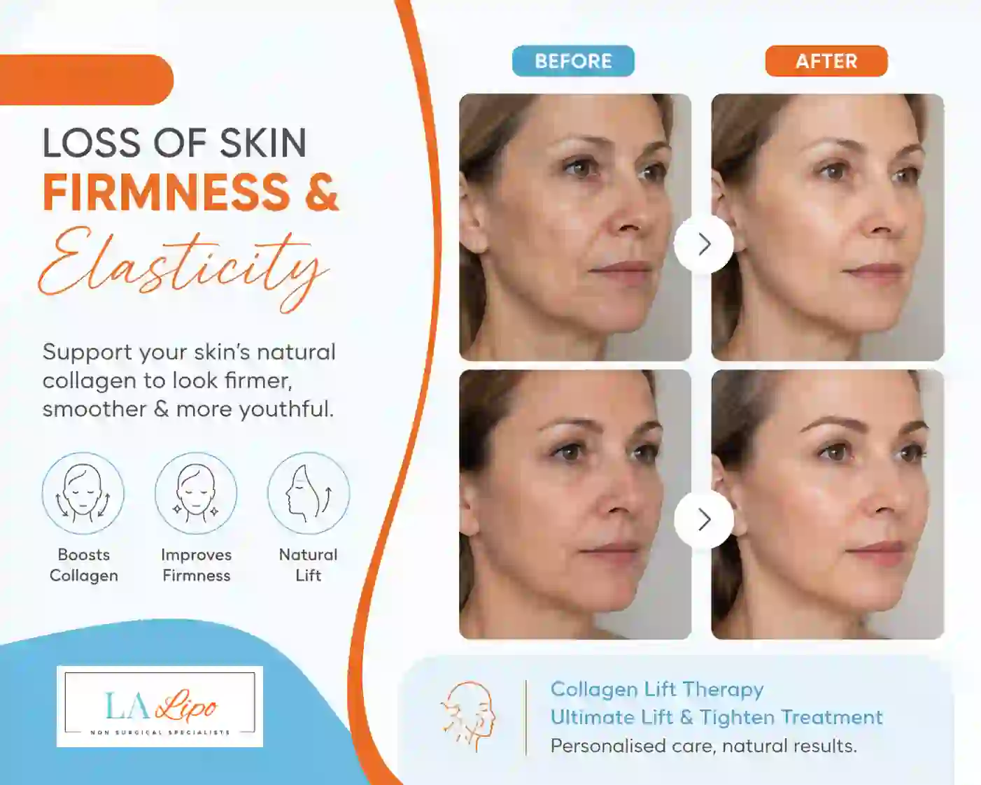 Sign #7: Loss of Skin Firmness and Elasticity Mill Hill
